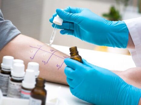 Alergia e Imunologia